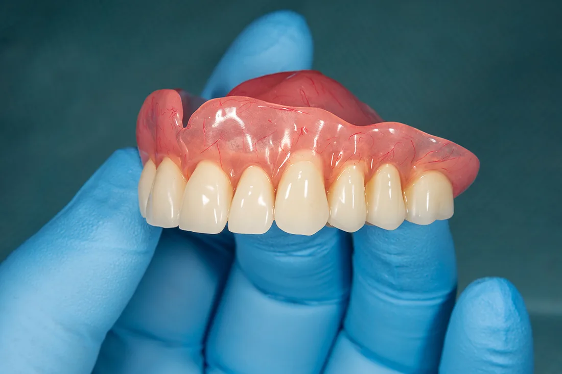Dentures left img