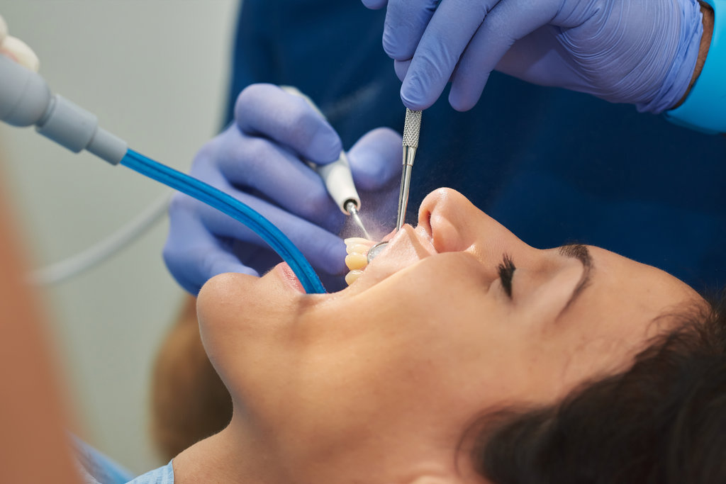 Detail plane of dental cleaning.