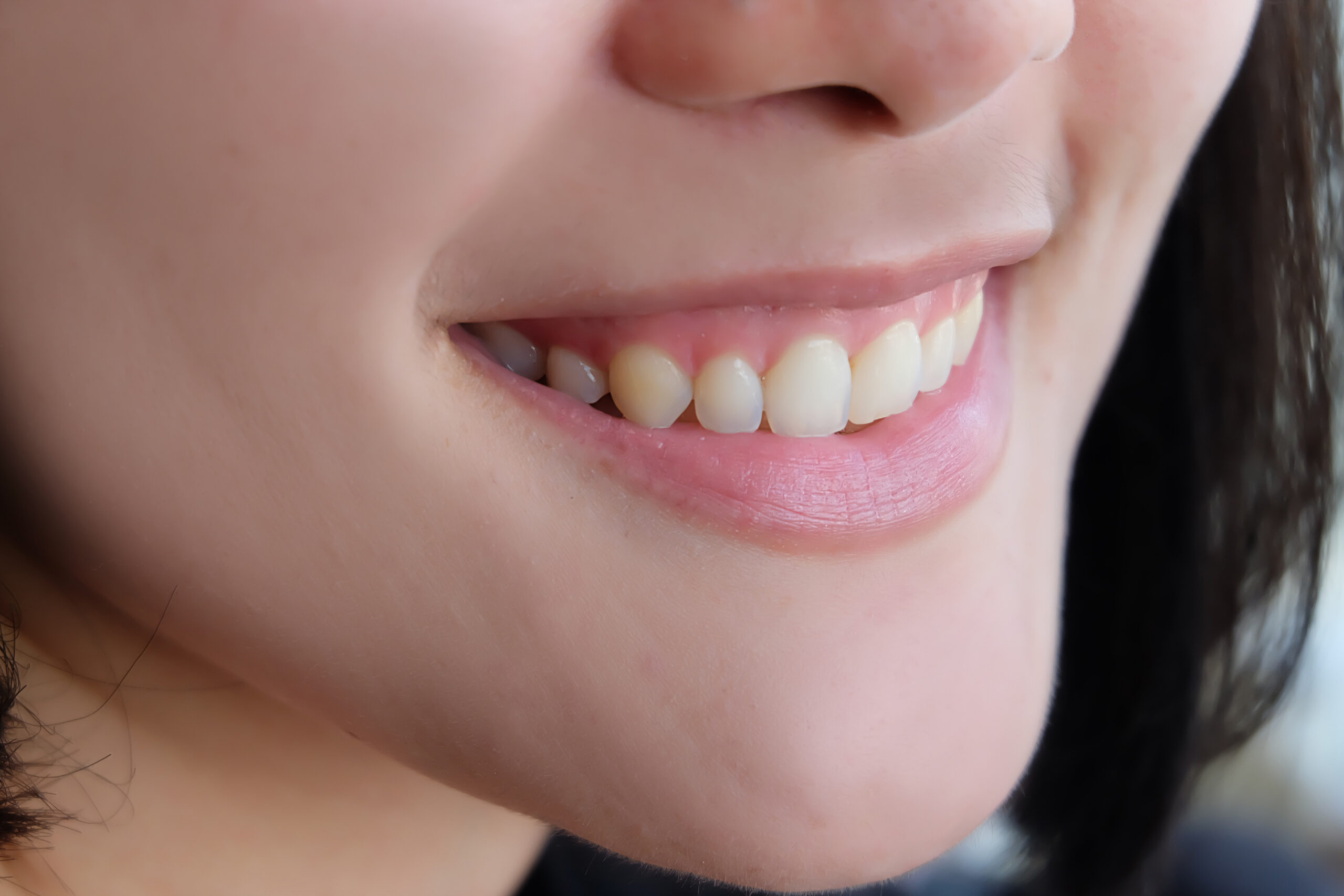 close up of a beautiful smile with white teeth 2026 03 26 11 57 05 utc